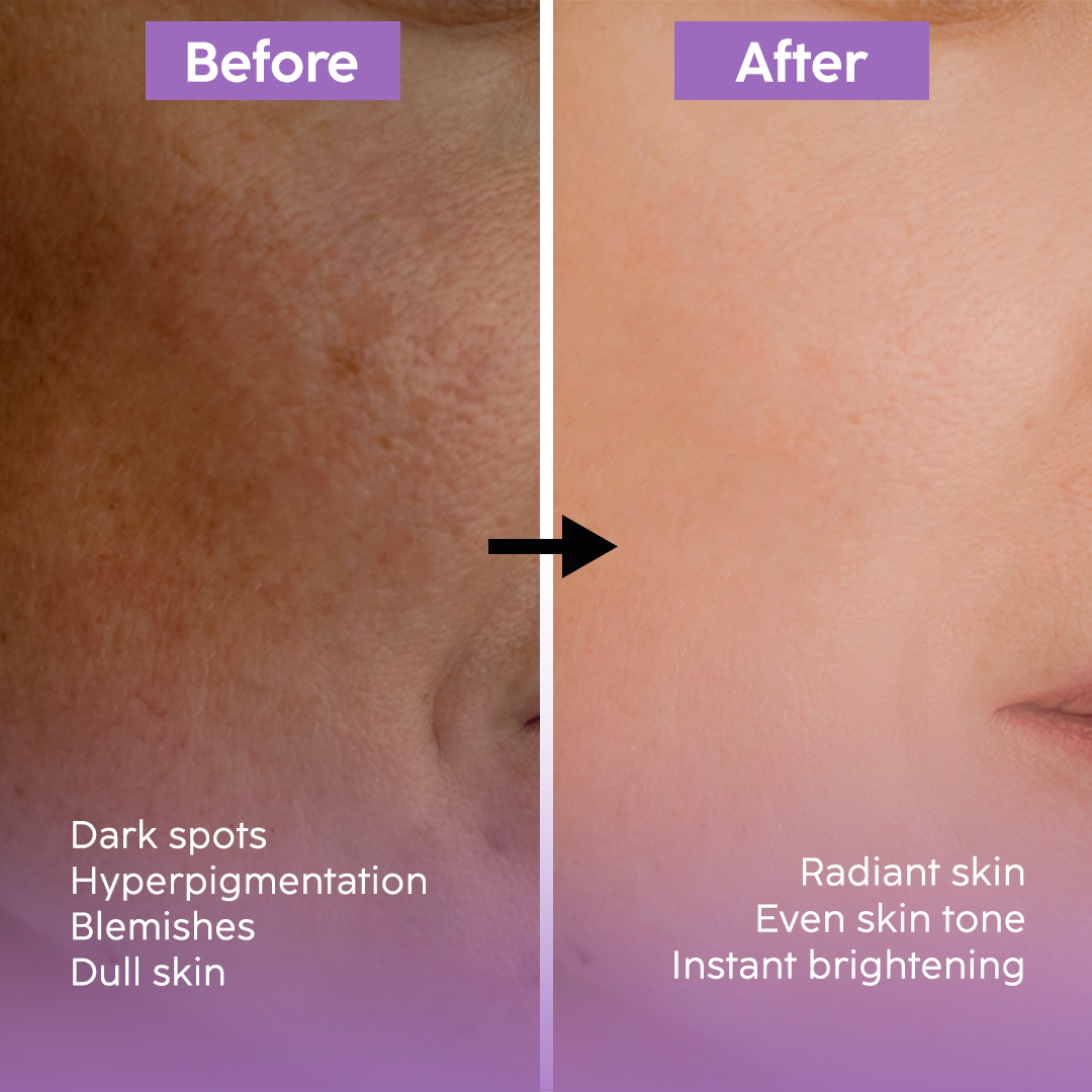 Deep Glow Kit - Bundle Pack