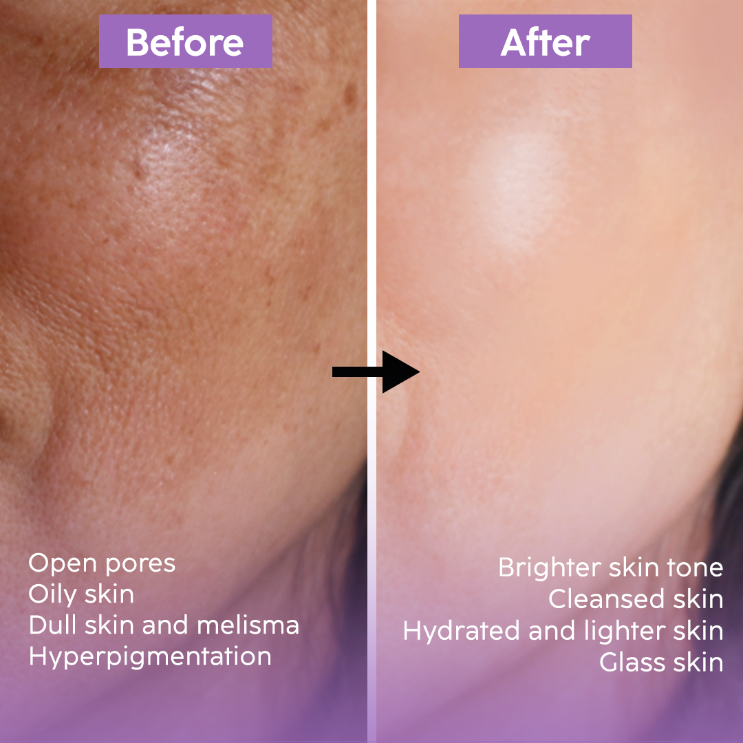 Clear, Brighter & Glass Skin Combo - Bundle Pack