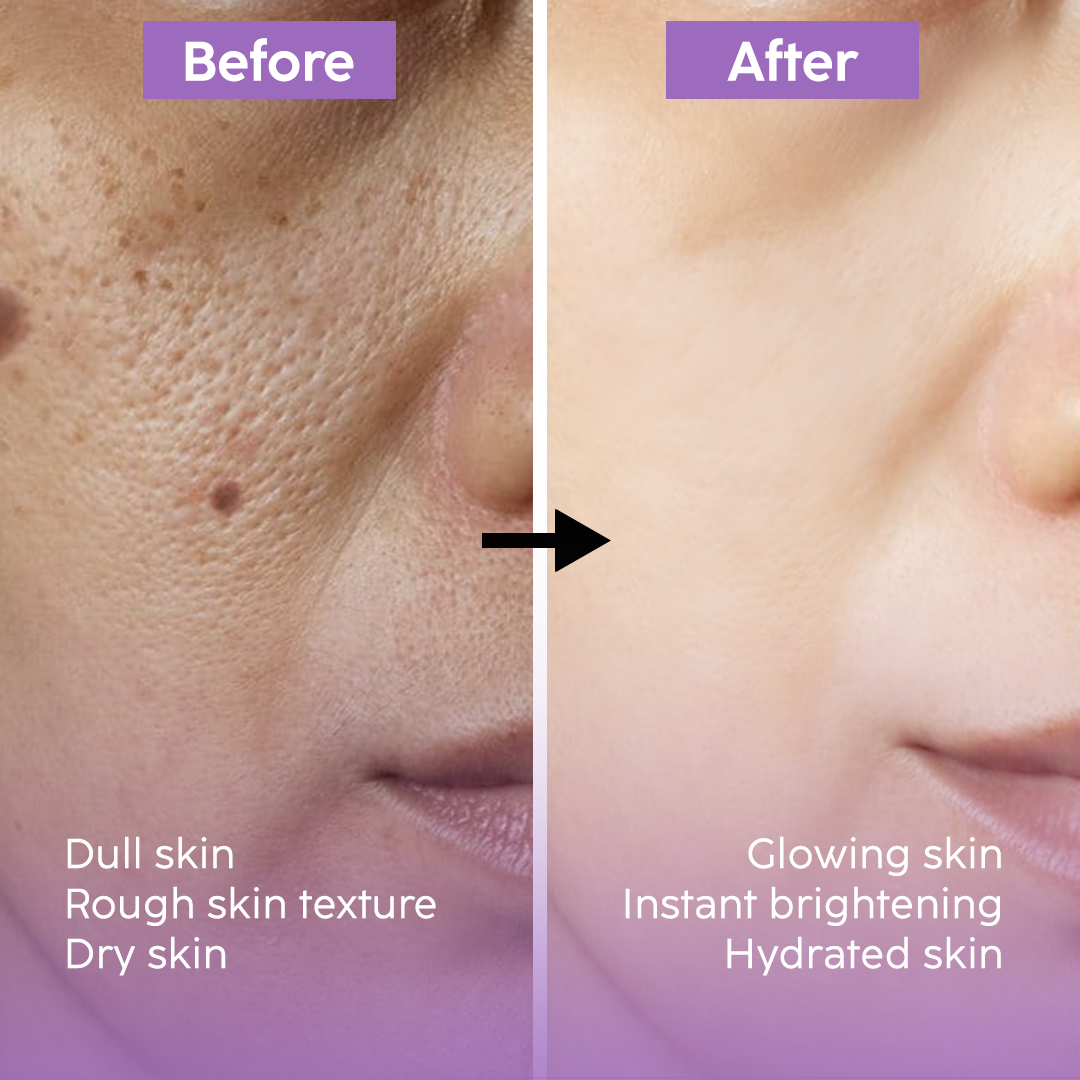 Glowing Combo - Bundle Pack