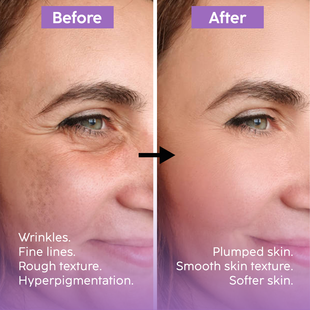 Anti Aging Combo - Bundle Pack