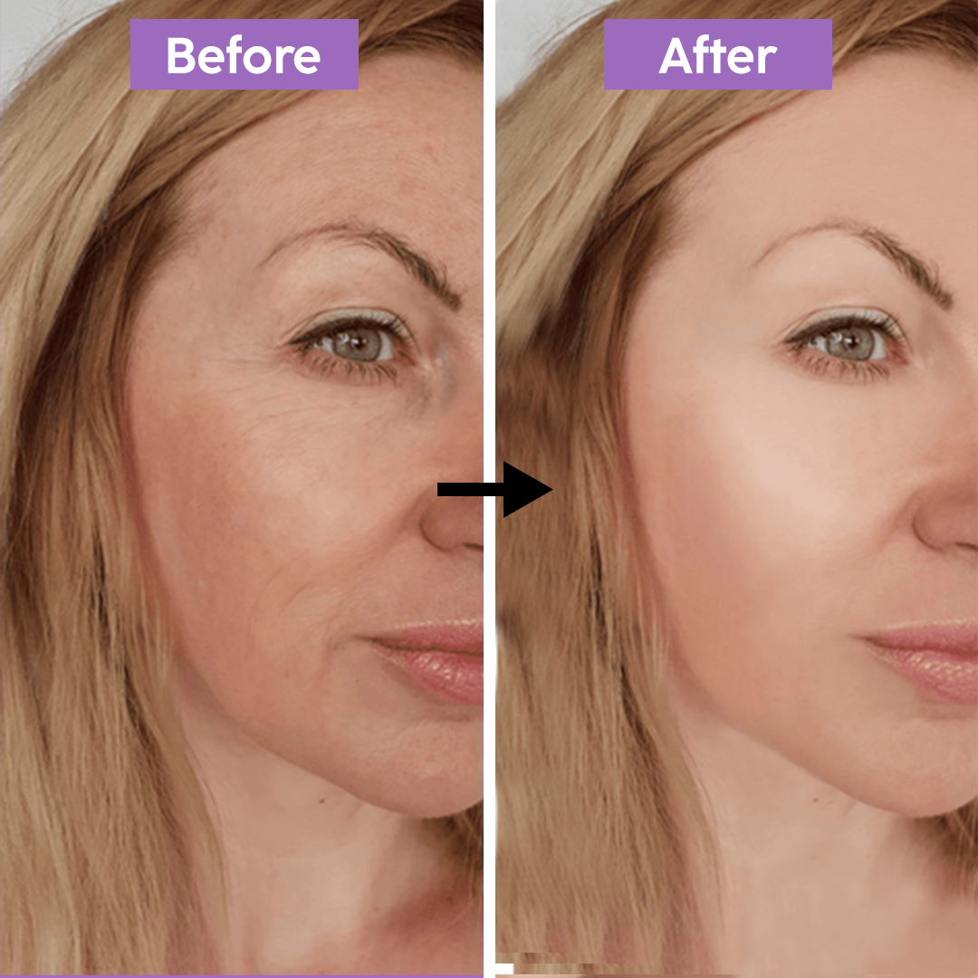 Hyaluronic Acid Serum
