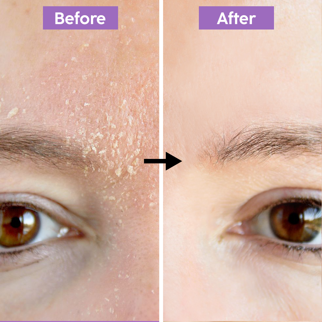 Radiant Silk – Moisturizer