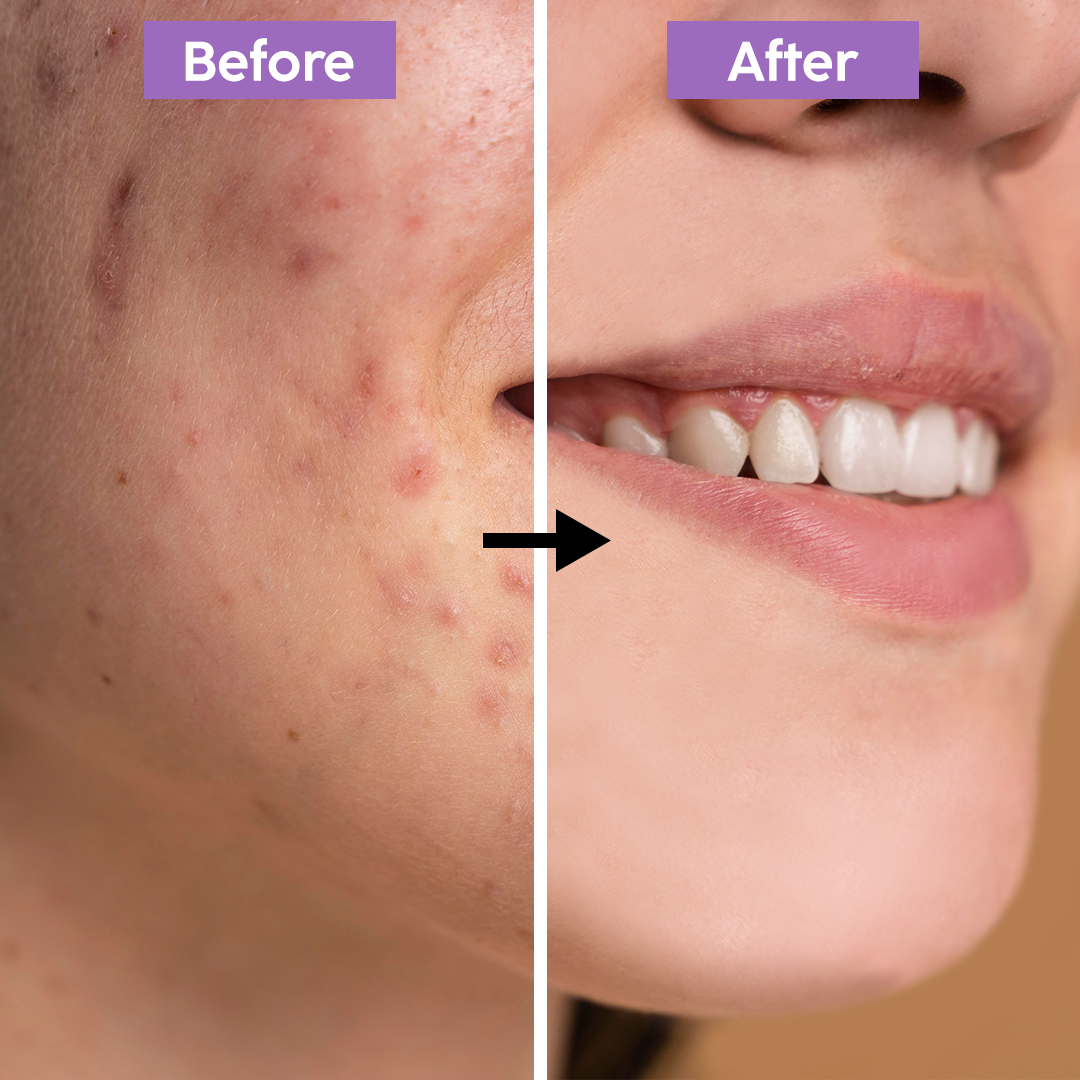 Tripple Action Face Wash