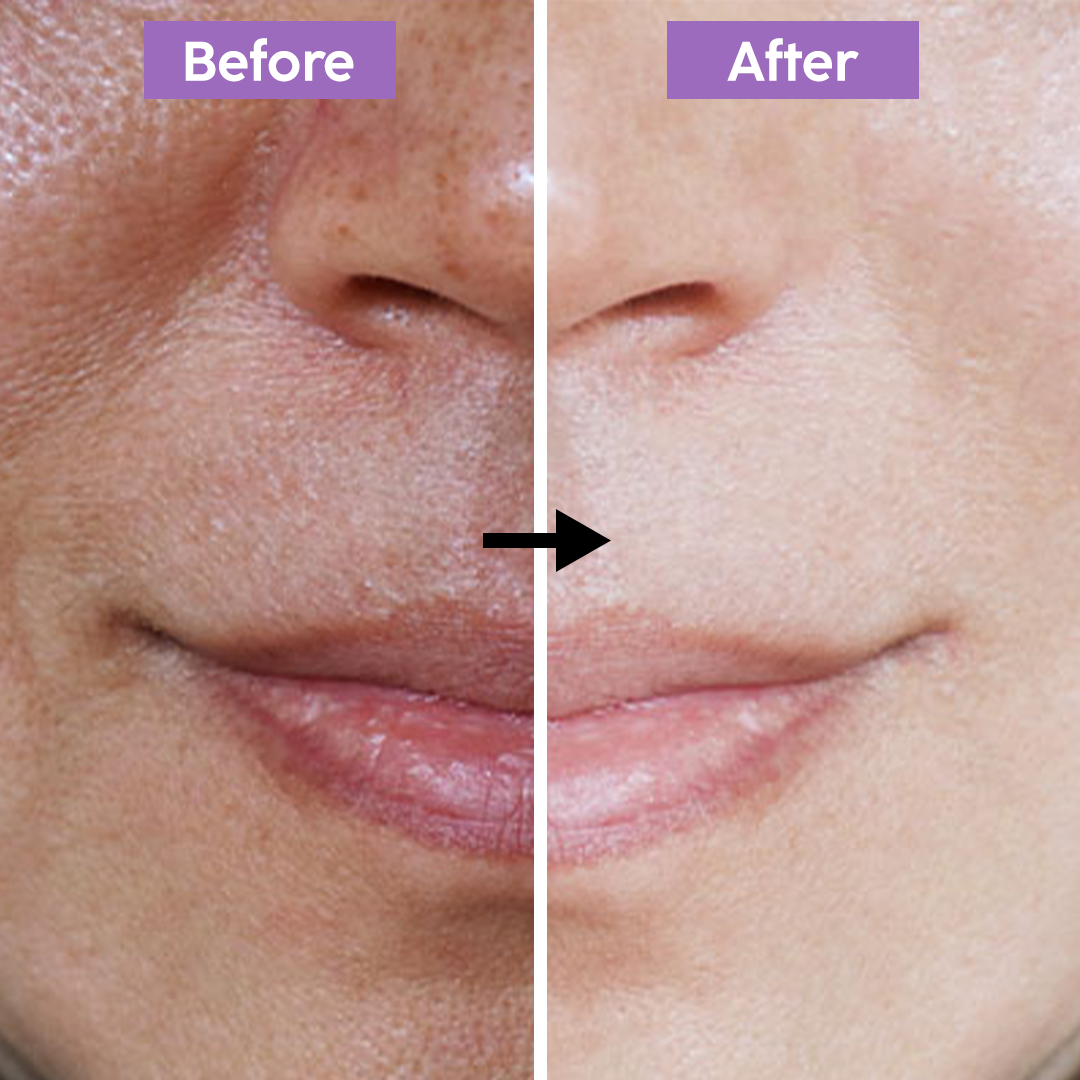 Vitamin-C Serum