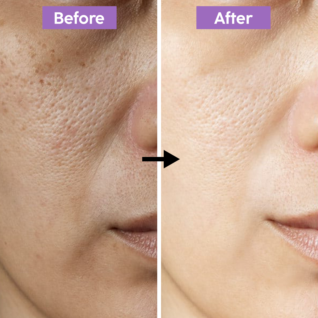 Brightening Cream