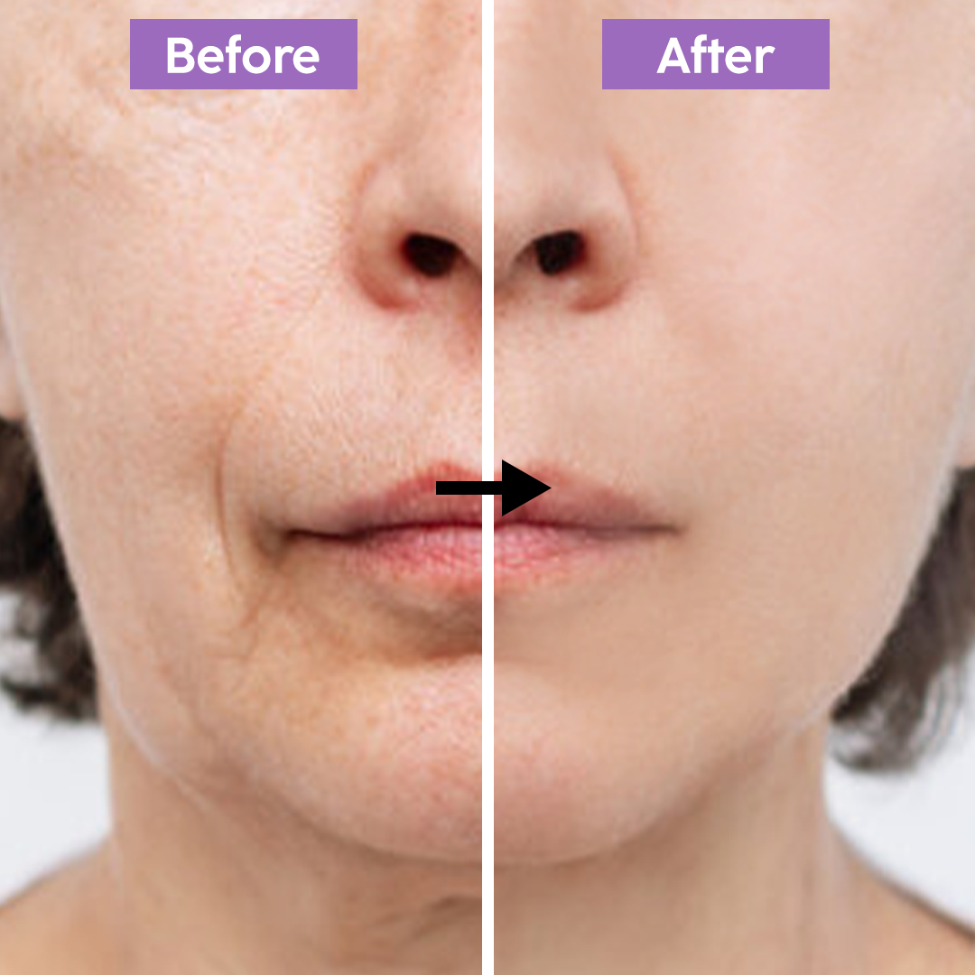 Retinol Night Serum